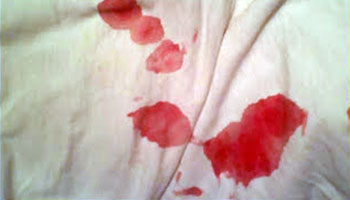 Blood in sperm but clear pee Hustler taboo free pics